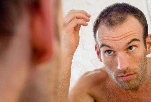 How much hair fall a day is normal and what is their life cycle? - Barbush  Hair Clinic